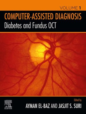 cover image of Diabetes and Fundus OCT